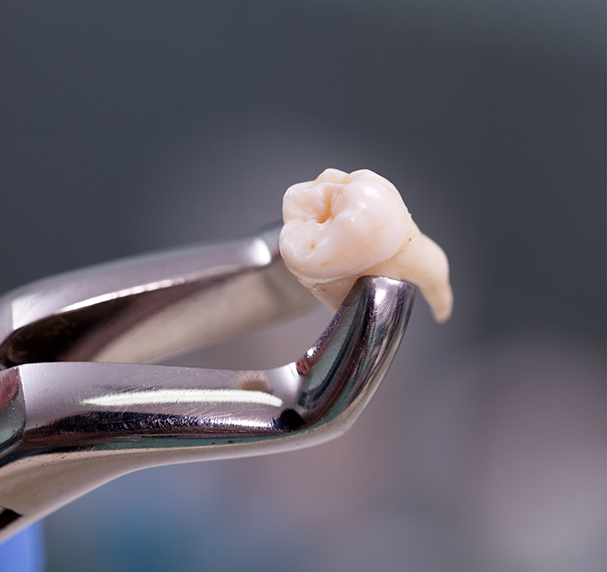 Close up of tooth held by forceps