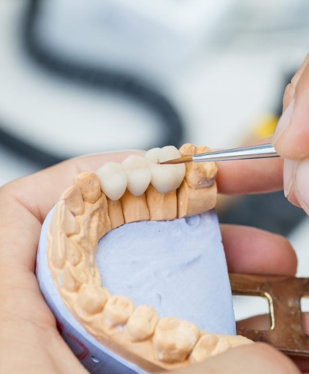 Dental ceramist crafting a dental bridge