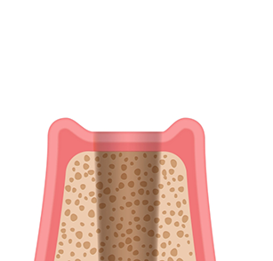 Illustration of empty socket