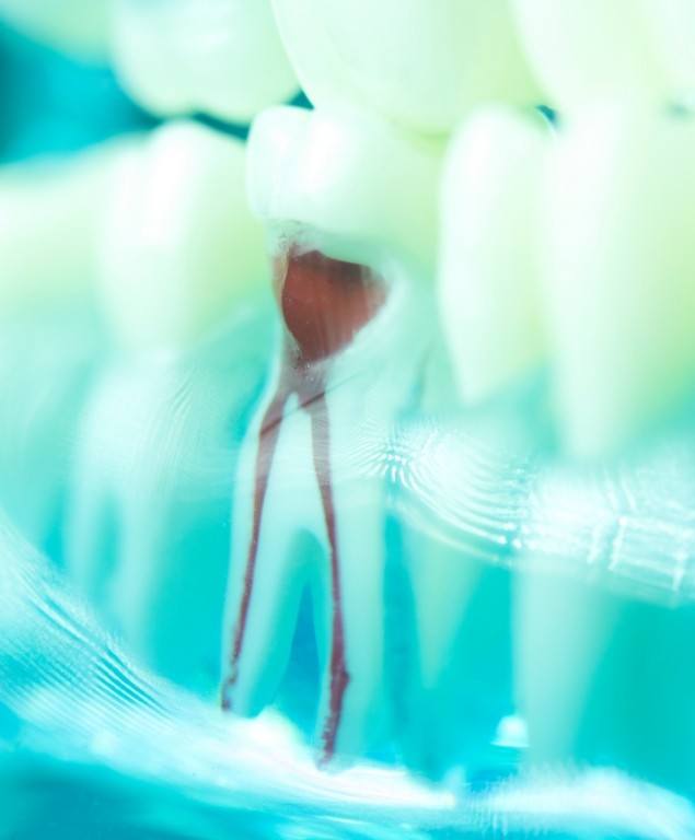 Model of tooth showing root canal pathways