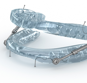 Close up of oral appliance on white surface