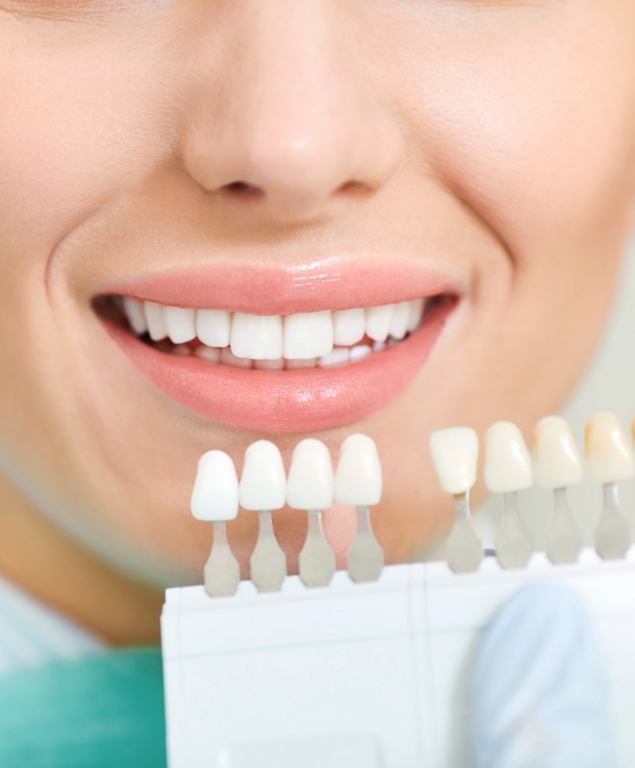 Close up of smile next to dental shade guide