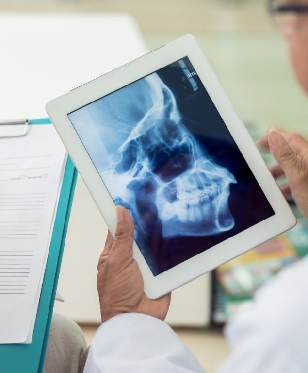 Dentist looking at x ray of a patient needing T M J treatment in Cambridge