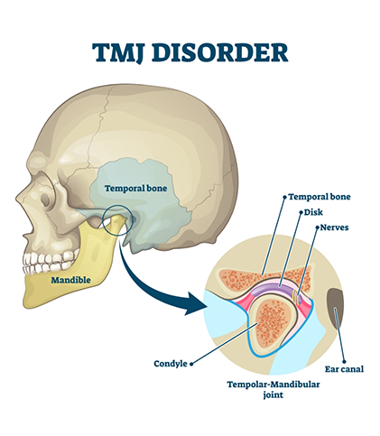 Diagram showing temporomandibular joint