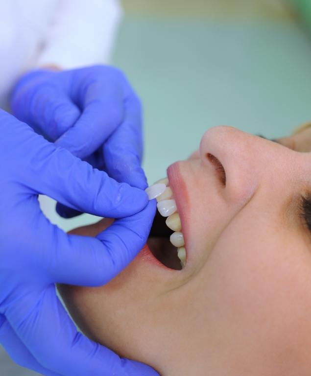 Cosmetic dentist fitting a patient with veneers in Cambridge